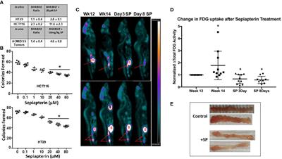 Uncoupled nitric oxide synthase activity promotes colorectal cancer progression